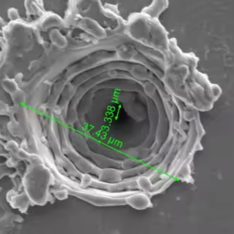 พรีซิชั่นเลเซอร์ไมโครเวียส